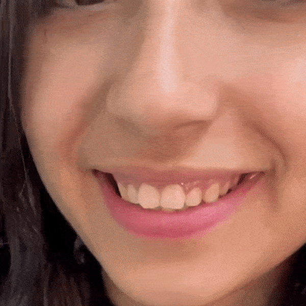 FLASH SALE: Fix Your Smile in 30 Seconds — 👨⚕Adjustable Snap-On Dentures😁